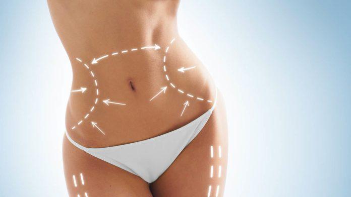 Advantages of experienced liposuction surgeons