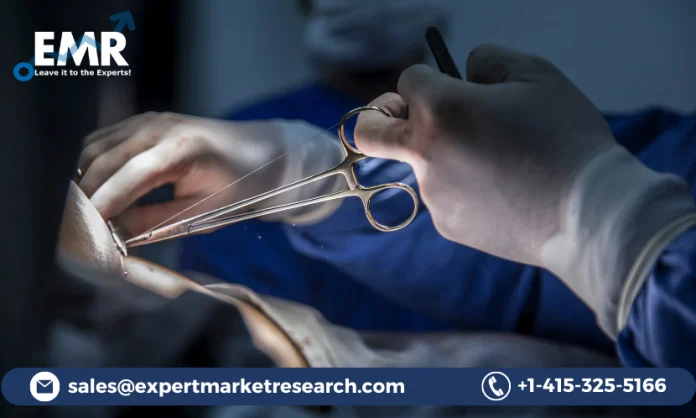 The market for surgical sutures has seen substantial growth due to factors such as growing number of surgical procedures and the robust growth of the healthcare industry