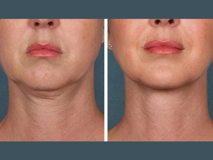 PRP Treatment in Dubai PRP Treatment in Dubai