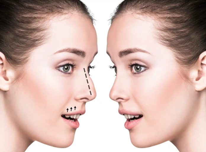 Rhinoplasty in Dubai