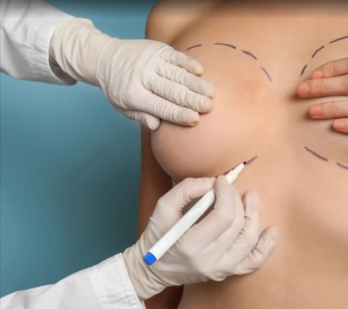 Breast Implants In Dubai