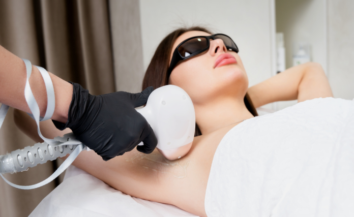 laser hair removal laser hair removal