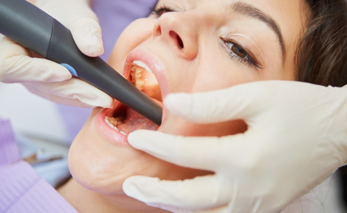 Root canal