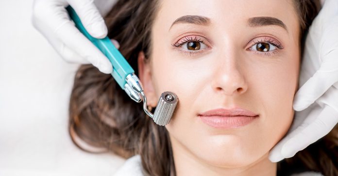 microneedling near La Jolla microneedling near La Jolla