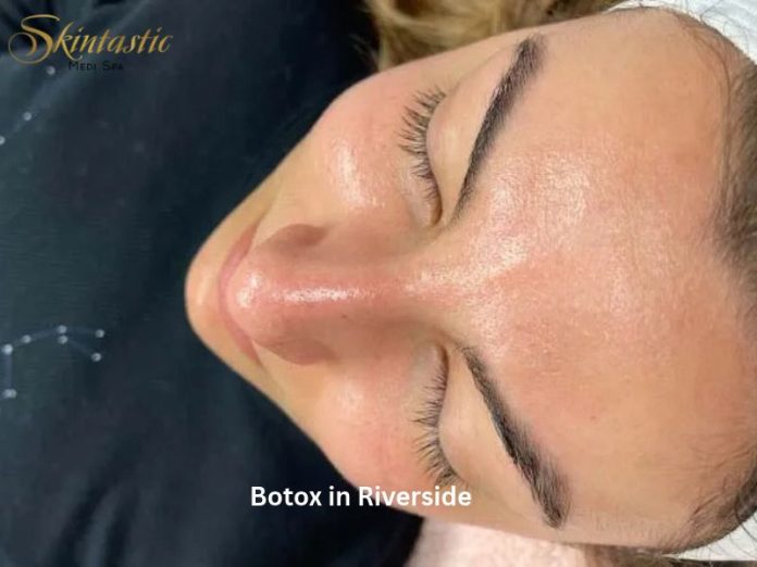 Botox in Riverside